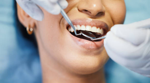 Best Emergency Gum Treatment in Coeur Dalene, ID