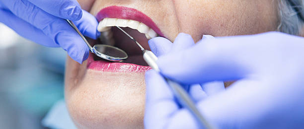 Best Emergency Denture Repair in Coeur Dalene, ID